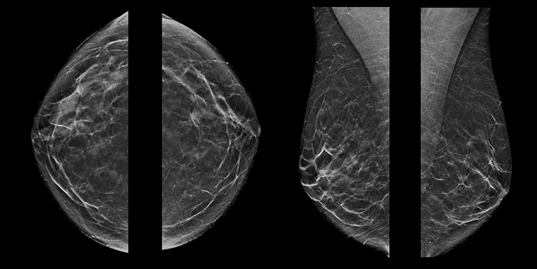 Annotation image