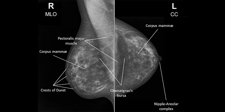 Annotation image