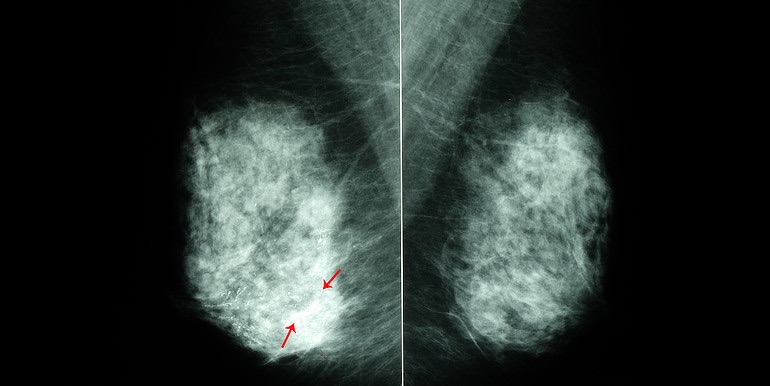 Annotation image